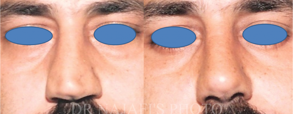 https://www.drhosseinnajafi.com/wp-content/uploads/2016/05/Picture1-2-1024x400.png