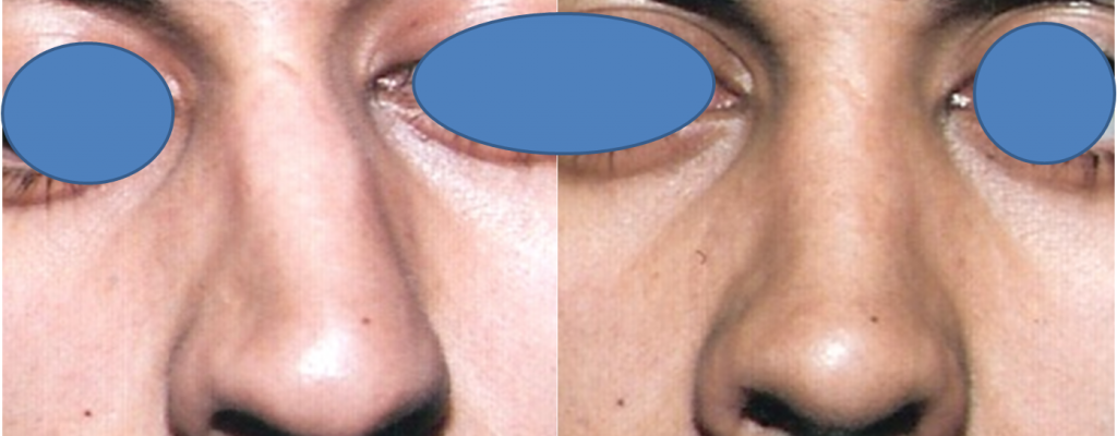 https://www.drhosseinnajafi.com/wp-content/uploads/2016/05/Picture10-3-1024x400.png