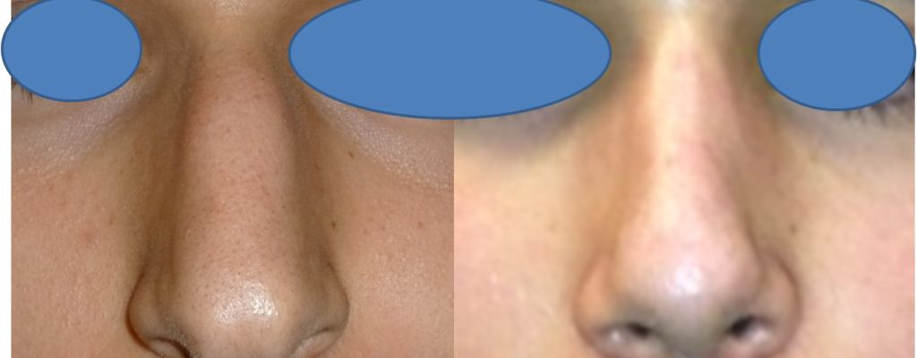 https://www.drhosseinnajafi.com/wp-content/uploads/2016/05/Picture15-1-1024x400.png