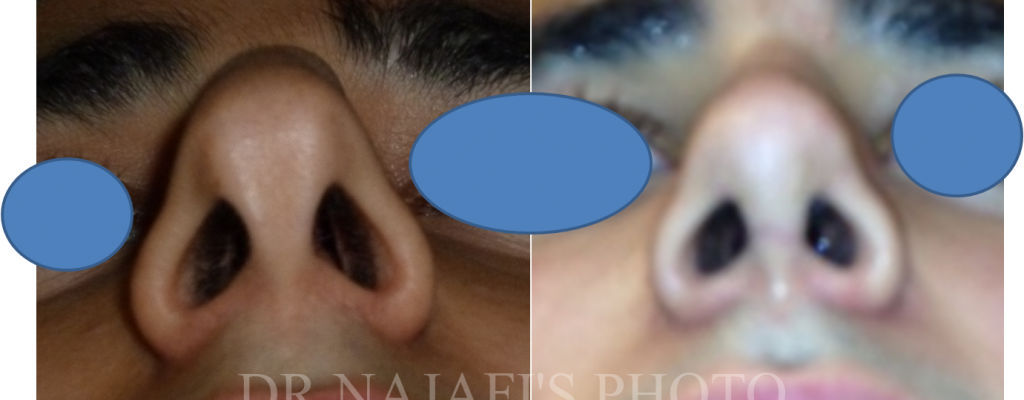https://www.drhosseinnajafi.com/wp-content/uploads/2016/05/Picture18-1-1024x400.png