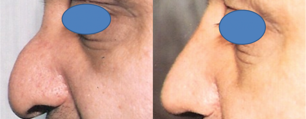 https://www.drhosseinnajafi.com/wp-content/uploads/2016/05/Picture2-3-1024x400.png