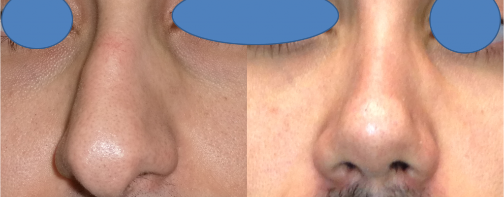 https://www.drhosseinnajafi.com/wp-content/uploads/2016/05/Picture21-1-1024x400.png