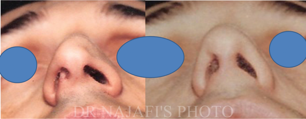 https://www.drhosseinnajafi.com/wp-content/uploads/2016/05/Picture3-2-1024x400.png