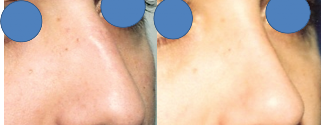 https://www.drhosseinnajafi.com/wp-content/uploads/2016/05/Picture4-2-1024x400.png