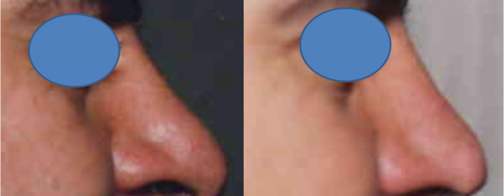 https://www.drhosseinnajafi.com/wp-content/uploads/2016/05/Picture50-1024x400.png