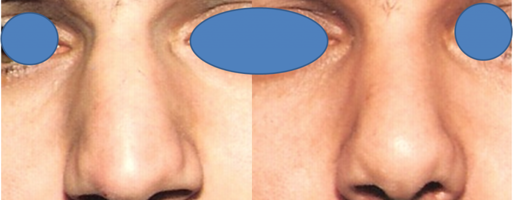 https://www.drhosseinnajafi.com/wp-content/uploads/2016/05/Picture7-3-1024x400.png