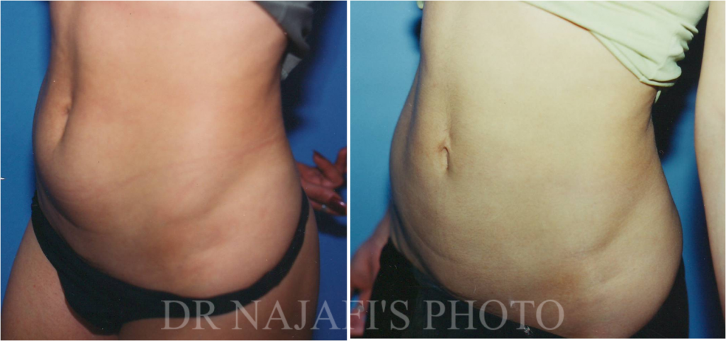 https://www.drhosseinnajafi.com/wp-content/uploads/2016/05/Picture8-1024x482.png
