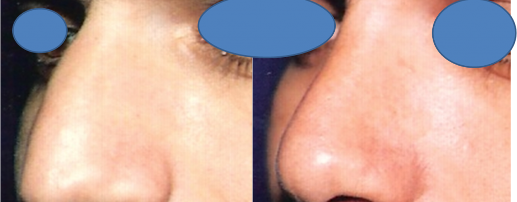 https://www.drhosseinnajafi.com/wp-content/uploads/2016/05/Picture8-3-1024x400.png
