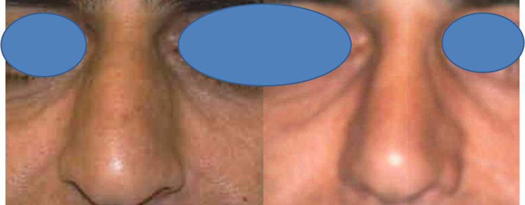 https://www.drhosseinnajafi.com/wp-content/uploads/2016/09/Picture12-1-1024x400.png