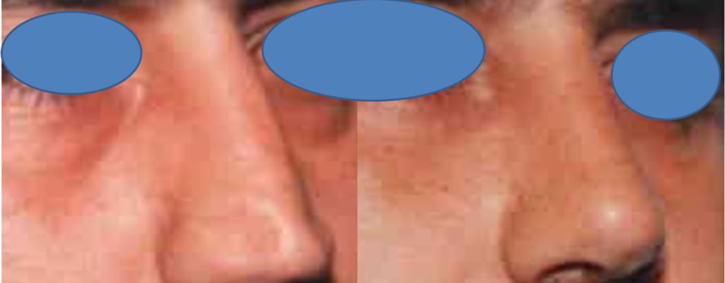 https://www.drhosseinnajafi.com/wp-content/uploads/2016/09/Picture28-1024x400.png