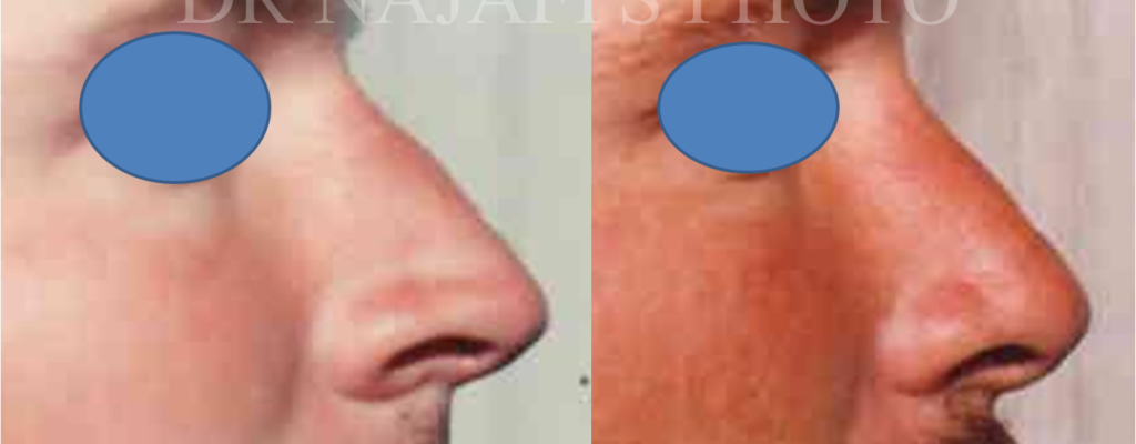 https://www.drhosseinnajafi.com/wp-content/uploads/2016/09/Picture3-1-1-1024x400.png